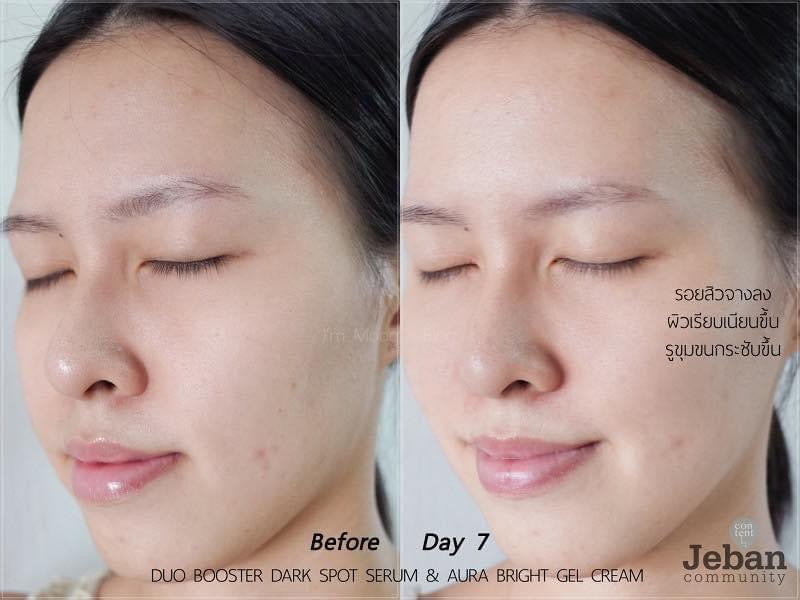 Baby Bright Duo Booster Dark Spot Serum and Aura Bright Gel Cream 6g+6g