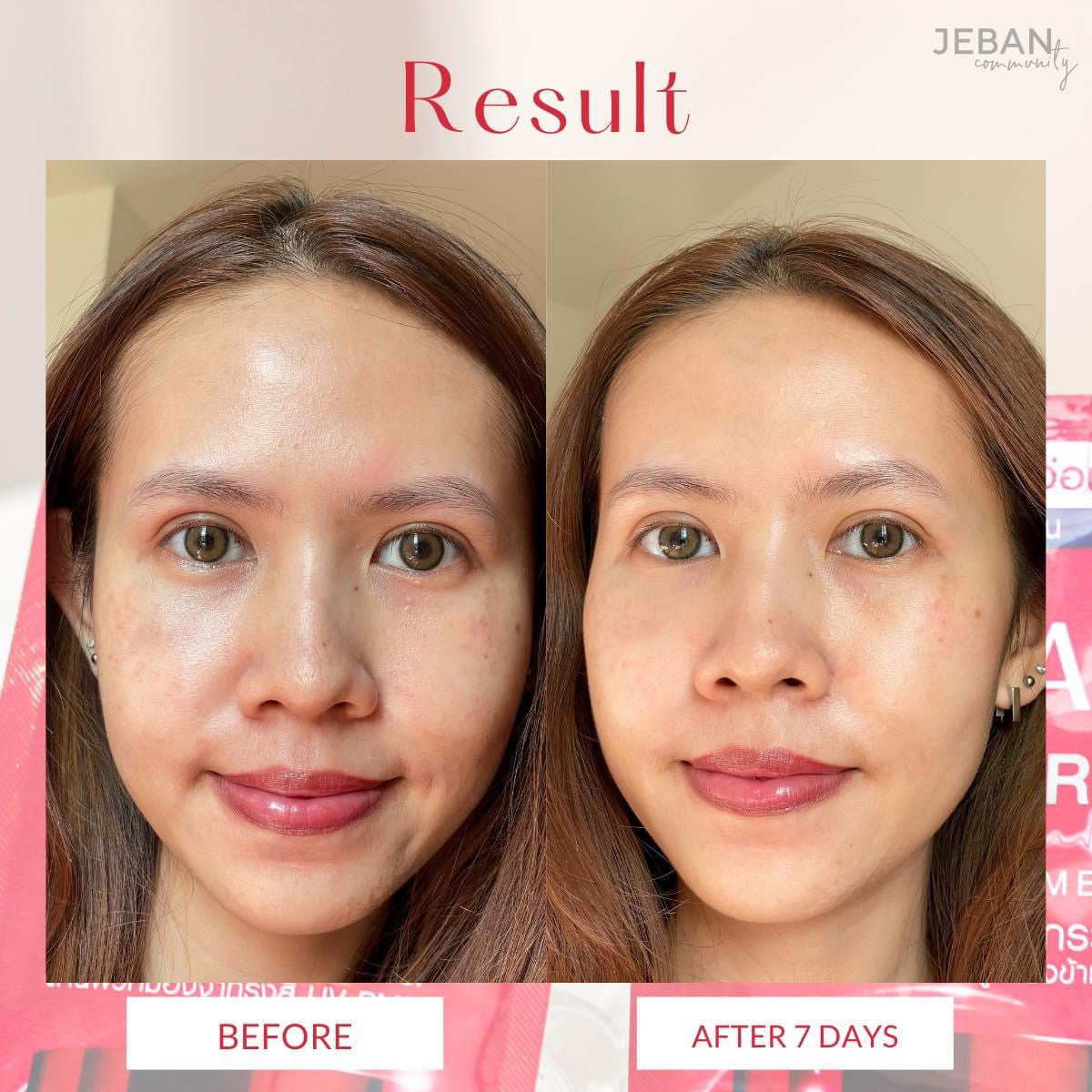 คา เอจจิ้ง โปร ไนท์ ทรีทเมนท์ 8ก