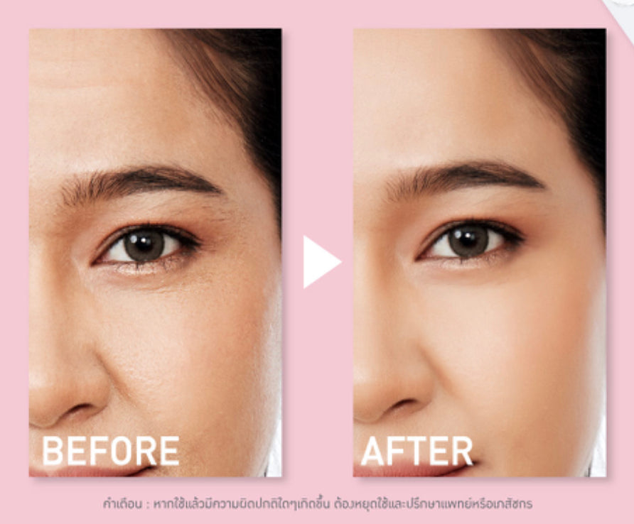 مجموعة تبييض البشرة BABY BRIGHT AGELESS 6G+6G