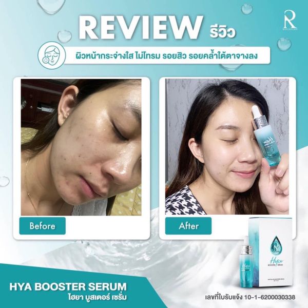 Ratcha Hya Booster Serum 15ml