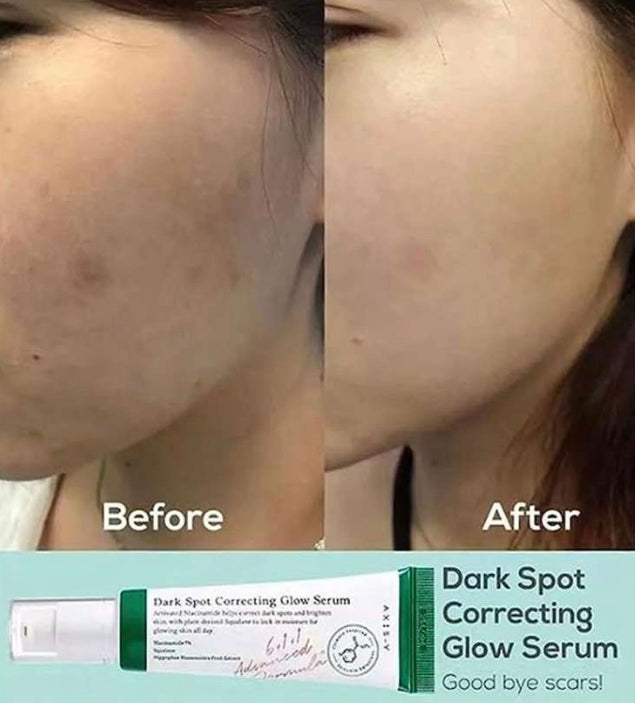 AXIS-Y Dark Spot Correcting Glow Serum