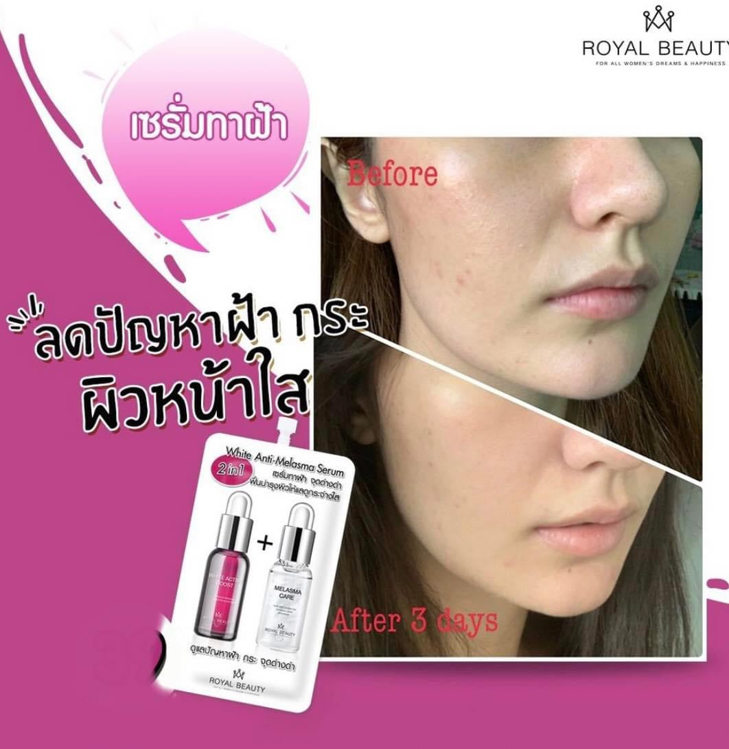 Royal Beauty White Anti Melasma Serum 7 ml