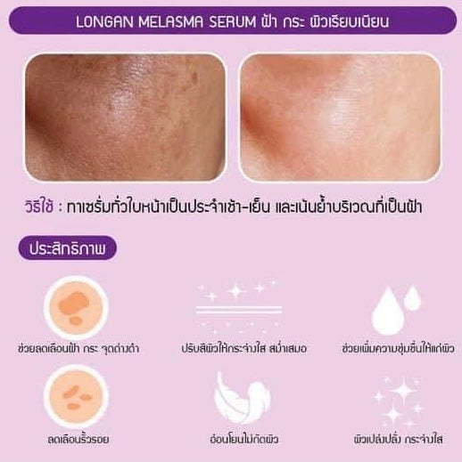 Jula's Herb Longan Melasma Serum