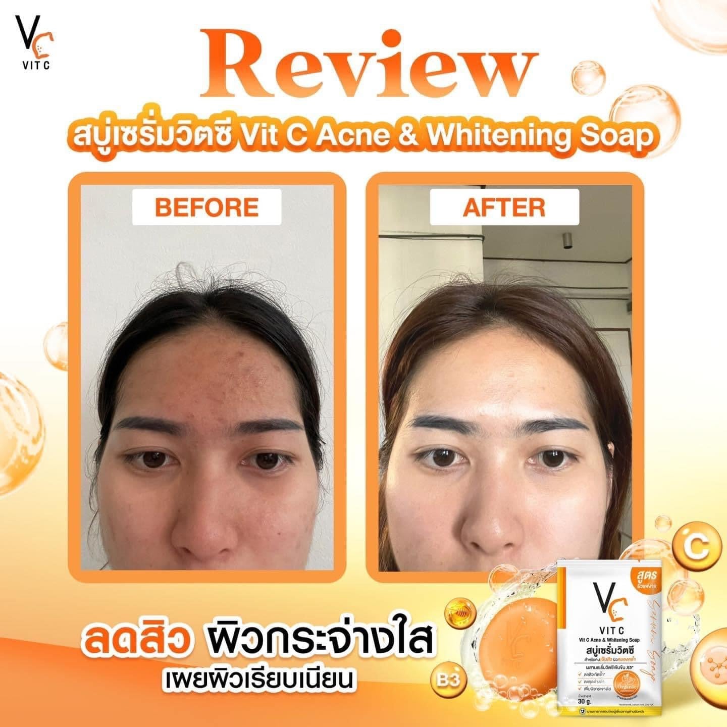 VC Vit C Ance & Whitening Soap 30g