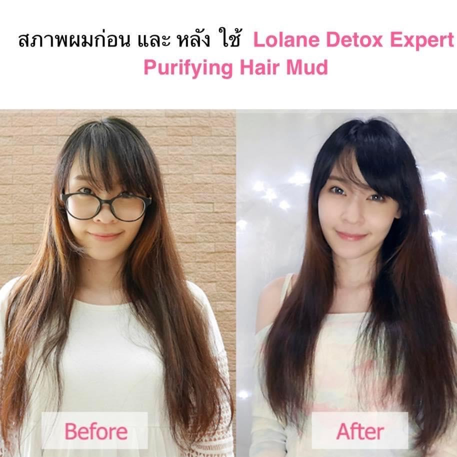 Lolane Intense Care Detox Expert Purifying Hair Treatment