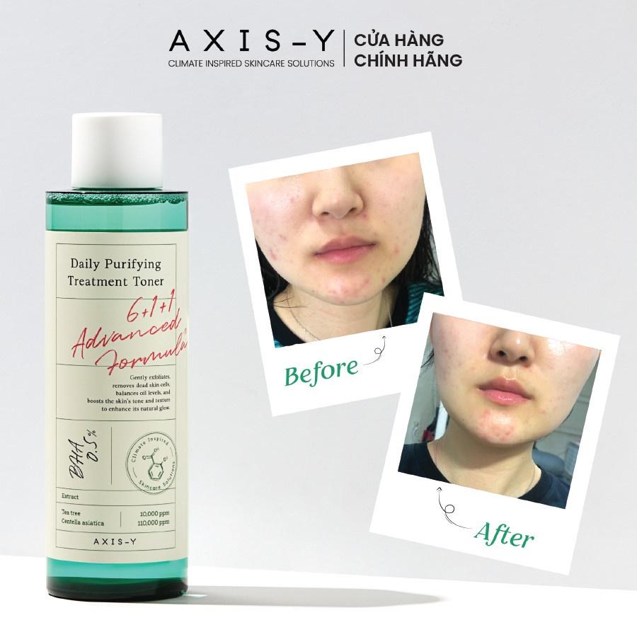 AXIS-Y Daily Purifying Treatment Toner