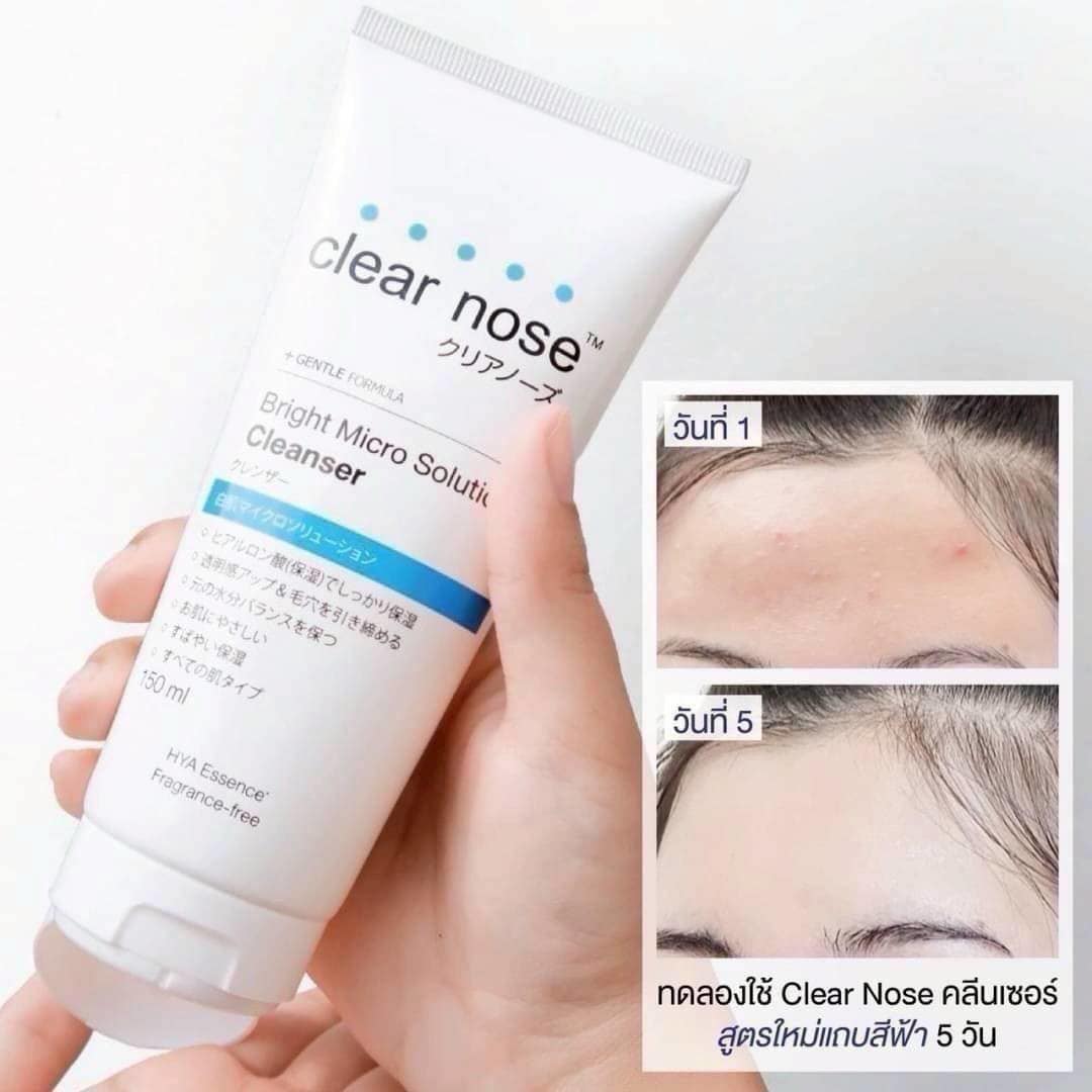 Clear Nose Bright Micro Solution Cleanser 150ml